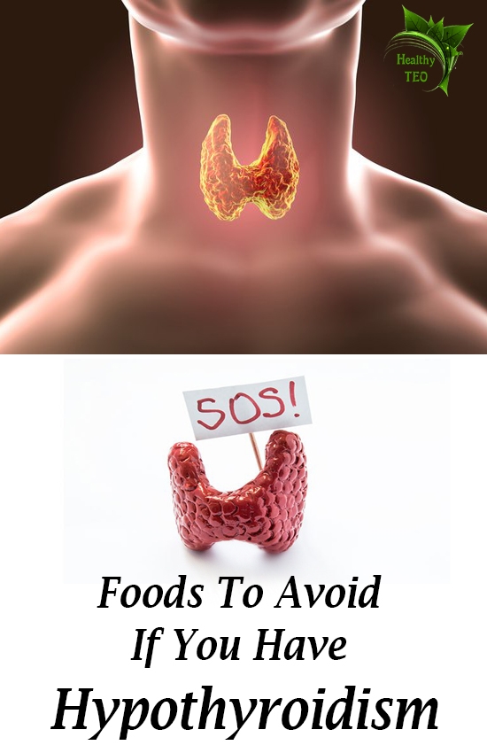 Hypothyroidism